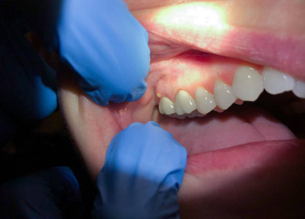 Best Emergency TMJ Treatment in Madison, IL