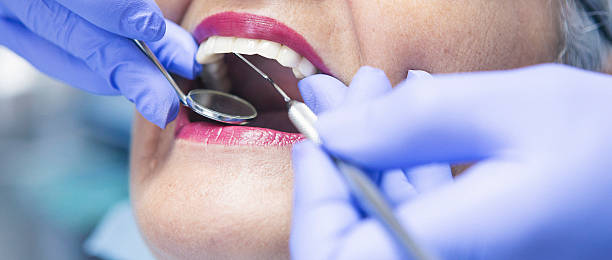 Best Emergency Gum Treatment in Madison, IL